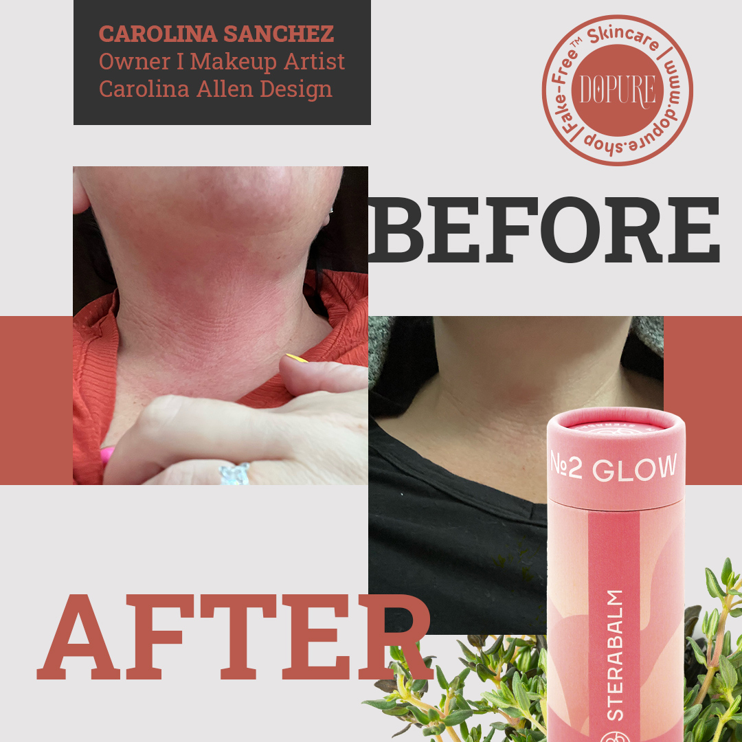 Carolina Sanchez before and after using STERABALM NO.2 GLOW